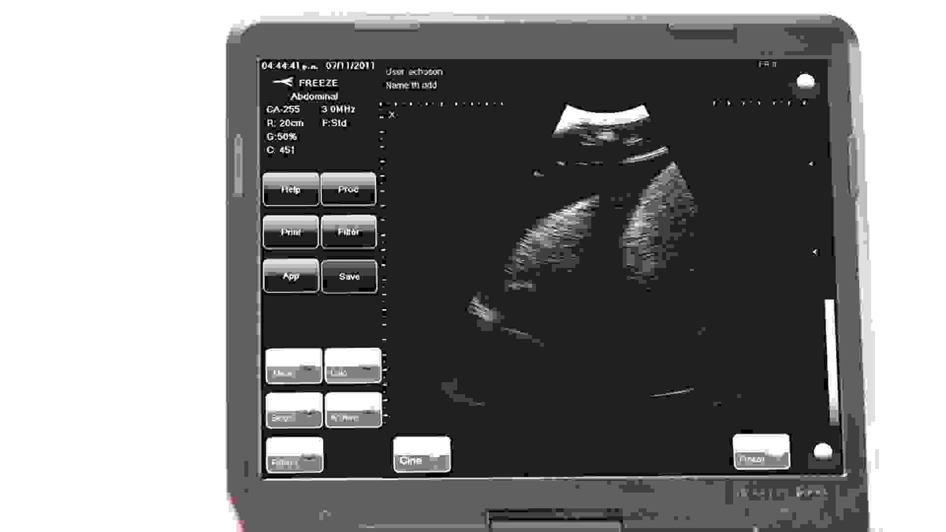 Ultrasound guided techniques practice on the chest drain model